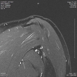fishing-injuries